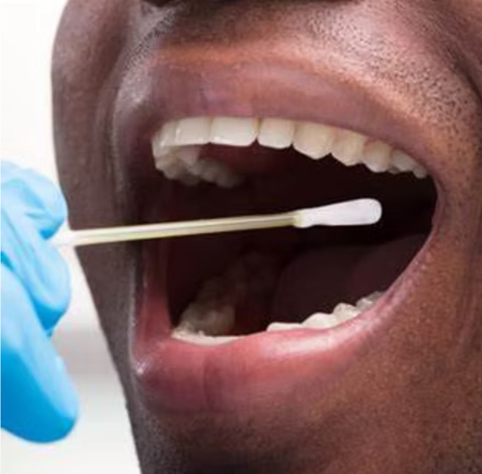 Pharmacogenomic Test